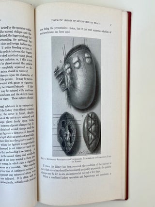 Urology in War: Wounds and Other Emergencies of the Genito-Urinary Organs Surgical and Medical (13/18)
