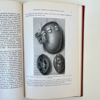 Urology in War: Wounds and Other Emergencies of the Genito-Urinary Organs Surgical and Medical (13/18)