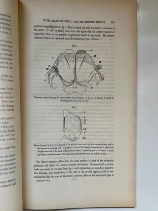 A Contribution to the Study of Descending Degenerations in the Brain and Spinal Cord, and of the... (3/9)