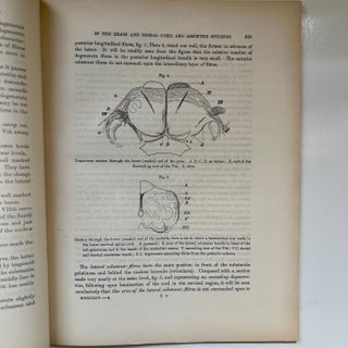 A Contribution to the Study of Descending Degenerations in the Brain and Spinal Cord, and of the... (3/9)