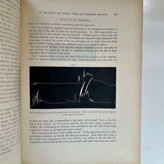 A Contribution to the Study of Descending Degenerations in the Brain and Spinal Cord, and of the... (5/9)