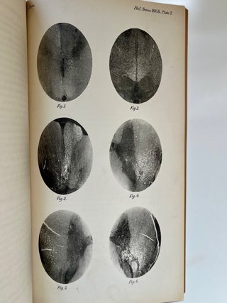 A Contribution to the Study of Descending Degenerations in the Brain and Spinal Cord, and of the... (7/9)